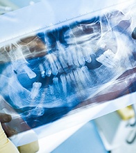 a hand holding a partial denture 