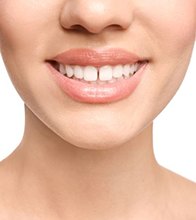 Woman’s smile with a gap between the front teeth