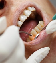 Closeup of patient during laser dentistry