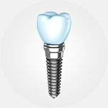 illustration of single implant