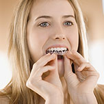 woman putting in invisalign