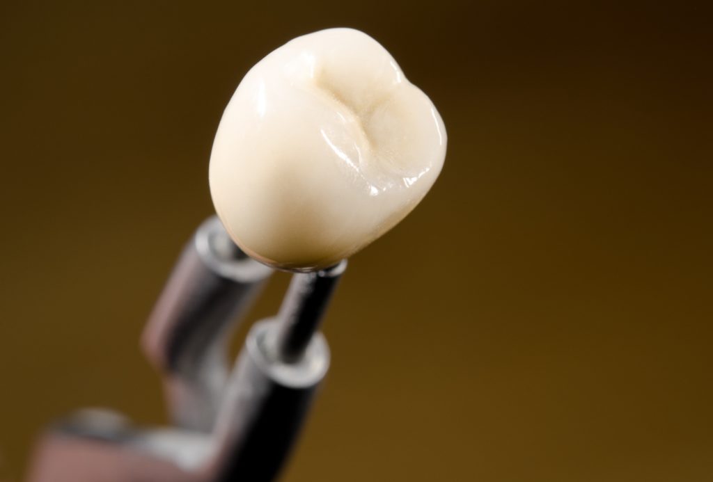 Repair Your Tooth in One Day with a CEREC Crown in Blaine