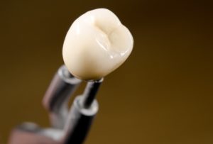 Dentist offering CEREC crown in Blaine. 