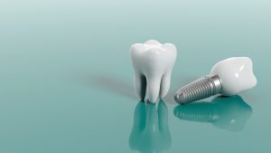 Molar and dental implant